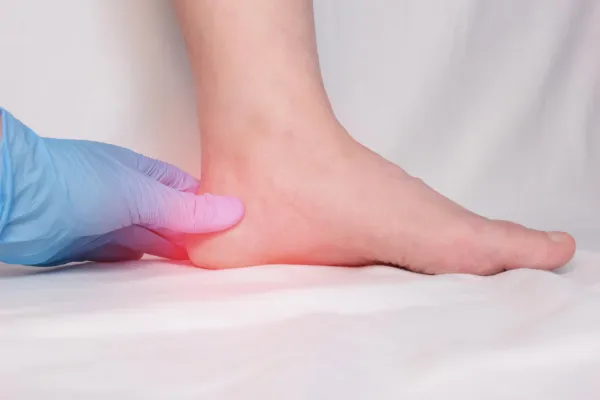 Heel Spur Treatment Adelaide